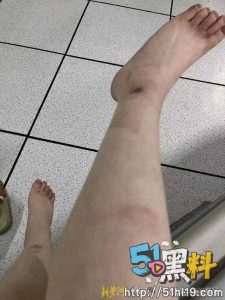 江西南昌李宜雪遭民警猥亵 因维权被送精神病医院 公安局十余人闯进她家里！