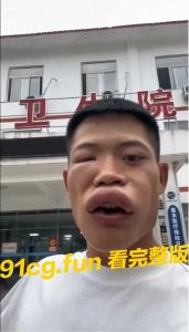 你是一个狠人 #蜜蜂