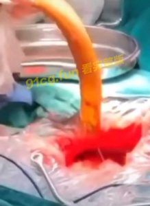 城会玩 黄鳝塞进下体，无法取出