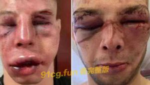 对手面目全非 #MMA